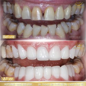 dịch vụ nha khoa giá rẻ