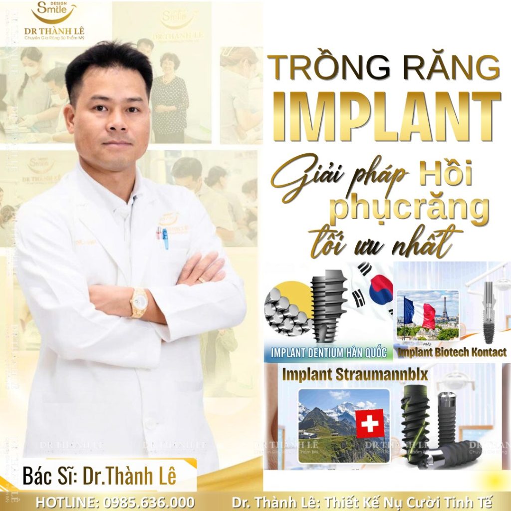 cấy implant