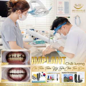 dịch vụ nha khoa giá rẻ