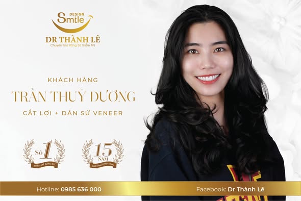 phẫu thuật cắt lợi