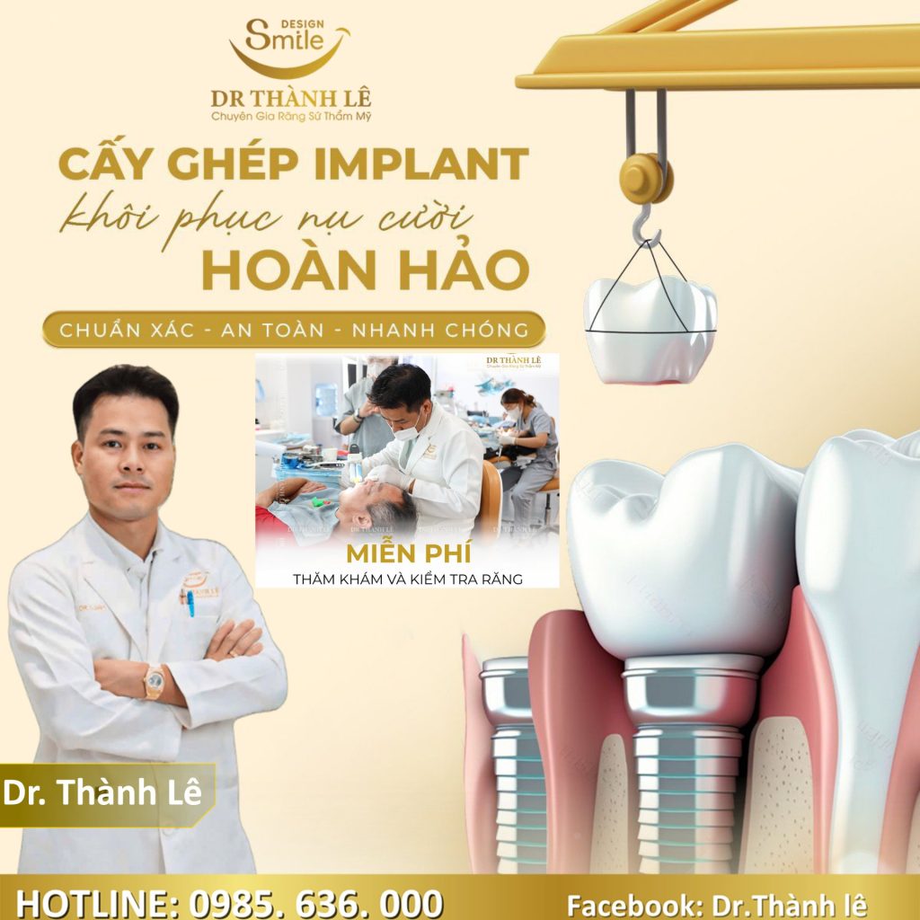 cấy implant