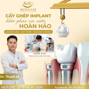 cấy implant